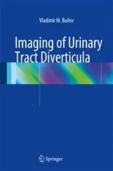 Book cover of Imaging of Urinary Tract Diverticula by Vladimir M. Builov