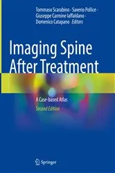 Book cover of Imaging Spine After Treatment (2nd ed.) by Tommaso Scarabino
