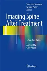 Book cover of Imaging Spine After Treatment by Tommaso Scarabino