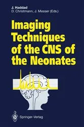 Book cover of Imaging Techniques of the CNS of the Neonates by Joseph Haddad