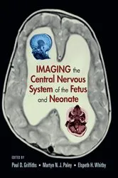 Book cover of Imaging the Central Nervous System of the Fetus and Neonate by Paul D. Griffiths