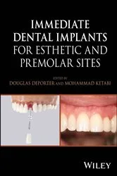Book cover of Immediate Dental Implants for Esthetic and Premolar Sites by Douglas Deporter