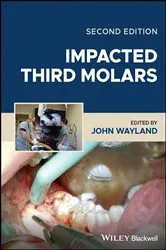 Book cover of Impacted Third Molars (2nd ed.) by John Wayland