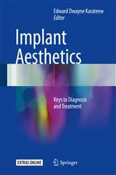 Book cover of Implant Aesthetics by Edward Dwayne Karateew