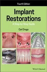 Book cover of Implant Restorations (4th ed.) by Carl Drago