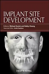 Book cover of Implant Site Development by Unknown