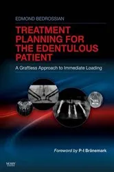 Book cover of Implant Treatment Planning for the Edentulous Patient by Bedrossian DDS, FACD, FACOMS, Edmond