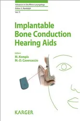 Book cover of Implantable Bone Conduction Hearing Aids by M. Kompis