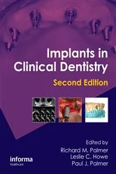 Book cover of Implants in Clinical Dentistry (2nd ed.) by Richard M. Palmer