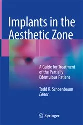 Book cover of Implants in the Aesthetic Zone by Todd R. Schoenbaum