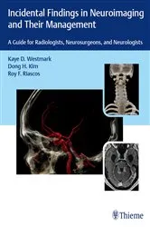 Book cover of Incidental Findings in Neuroimaging and Their Management by Kaye D. Westmark