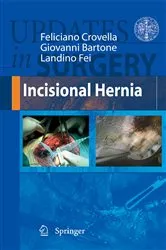 Book cover of Incisional Hernia by Feliciano Crovella