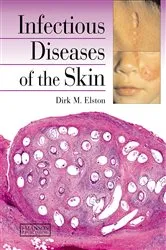 Book cover of Infectious Diseases of the Skin by Dirk Elston