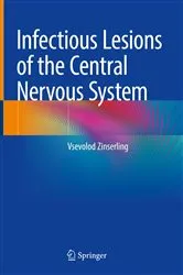 Book cover of Infectious Lesions of the Central Nervous System by Vsevolod Zinserling
