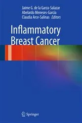 Book cover of Inflammatory Breast Cancer by Jaime G. de la Garza-Salazar