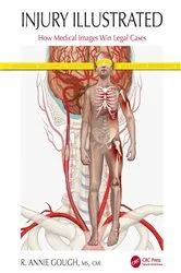 Book cover of Injury Illustrated by Unknown