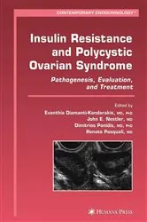 Book cover of Insulin Resistance and Polycystic Ovarian Syndrome by Evanthia Diamanti-Kandarakis