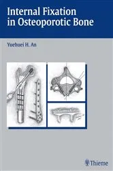 Book cover of Internal Fixation in Osteoporotic Bone by Yuehuei H. An