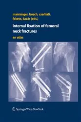 Book cover of Internal fixation of femoral neck fractures by Jenó Manninger