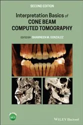 Book cover of Interpretation Basics of Cone Beam Computed Tomography (2nd ed.) by Shawneen M. Gonzalez