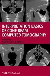 Book cover of Interpretation Basics of Cone Beam Computed Tomography by Shawneen M. Gonzalez