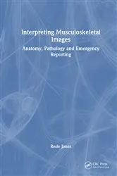 Book cover of Interpreting Musculoskeletal Images by Rosie Jones