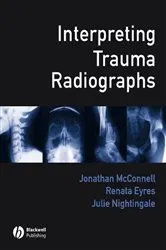Book cover of Interpreting Trauma Radiographs by Jonathan McConnell