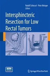 Book cover of Intersphincteric Resection for Low Rectal Tumors by Rudolf Schiessel