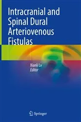 Book cover of Intracranial and Spinal Dural Arteriovenous Fistulas by Xianli Lv