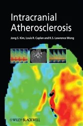 Book cover of Intracranial Atherosclerosis by Jong S. Kim