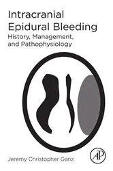 Book cover of Intracranial Epidural Bleeding by Jeremy Christopher Ganz