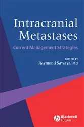 Book cover of Intracranial Metastases by Raymond Sawaya