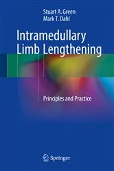 Book cover of Intramedullary Limb Lengthening by Stuart A. Green
