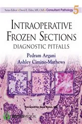Book cover of Intraoperative Frozen Sections by Pedram Argani