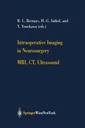 Book cover of Intraoperative Imaging in Neurosurgery by Unknown