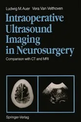 Book cover of Intraoperative Ultrasound Imaging in Neurosurgery by Ludwig M. Auer
