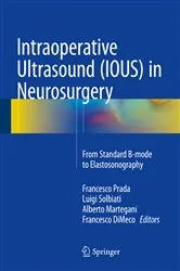 Book cover of Intraoperative Ultrasound (IOUS) in Neurosurgery by Francesco Prada