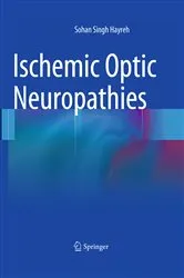 Book cover of Ischemic Optic Neuropathies by Sohan Singh Hayreh