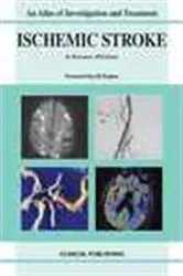 Book cover of Ischemic Stroke by IE Silverman