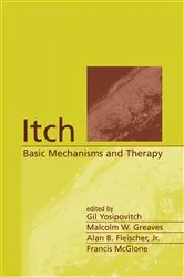 Book cover of Itch by Simon Mayo