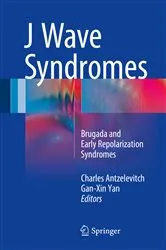 Book cover of J Wave Syndromes by Charles Antzelevitch