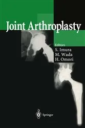 Book cover of Joint Arthroplasty by Shinichi Imura