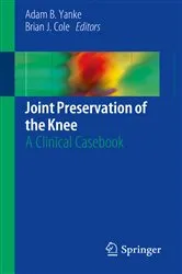 Book cover of Joint Preservation of the Knee by Adam B. Yanke