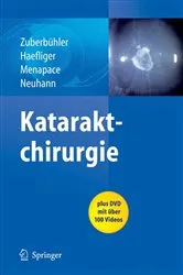 Book cover of Kataraktchirurgie by Bruno Zuberbuhler