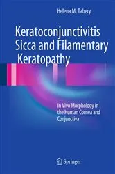 Book cover of Keratoconjunctivitis Sicca and Filamentary Keratopathy by Helena M. Tabery