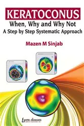 Book cover of Keratoconus by Mazen M. Sinjab