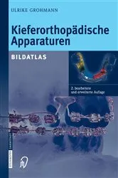 Book cover of Kieferorthopädische Apparaturen (2nd ed.) by Ulrike Grohmann