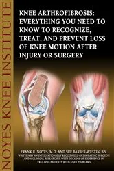 Book cover of Knee Arthrofibrosis by Frank Noyes