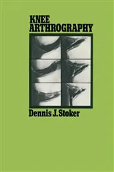 Book cover of Knee Arthrography by Dennis J. Stoker