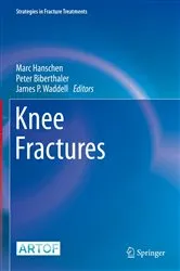 Book cover of Knee Fractures by Marc Hanschen